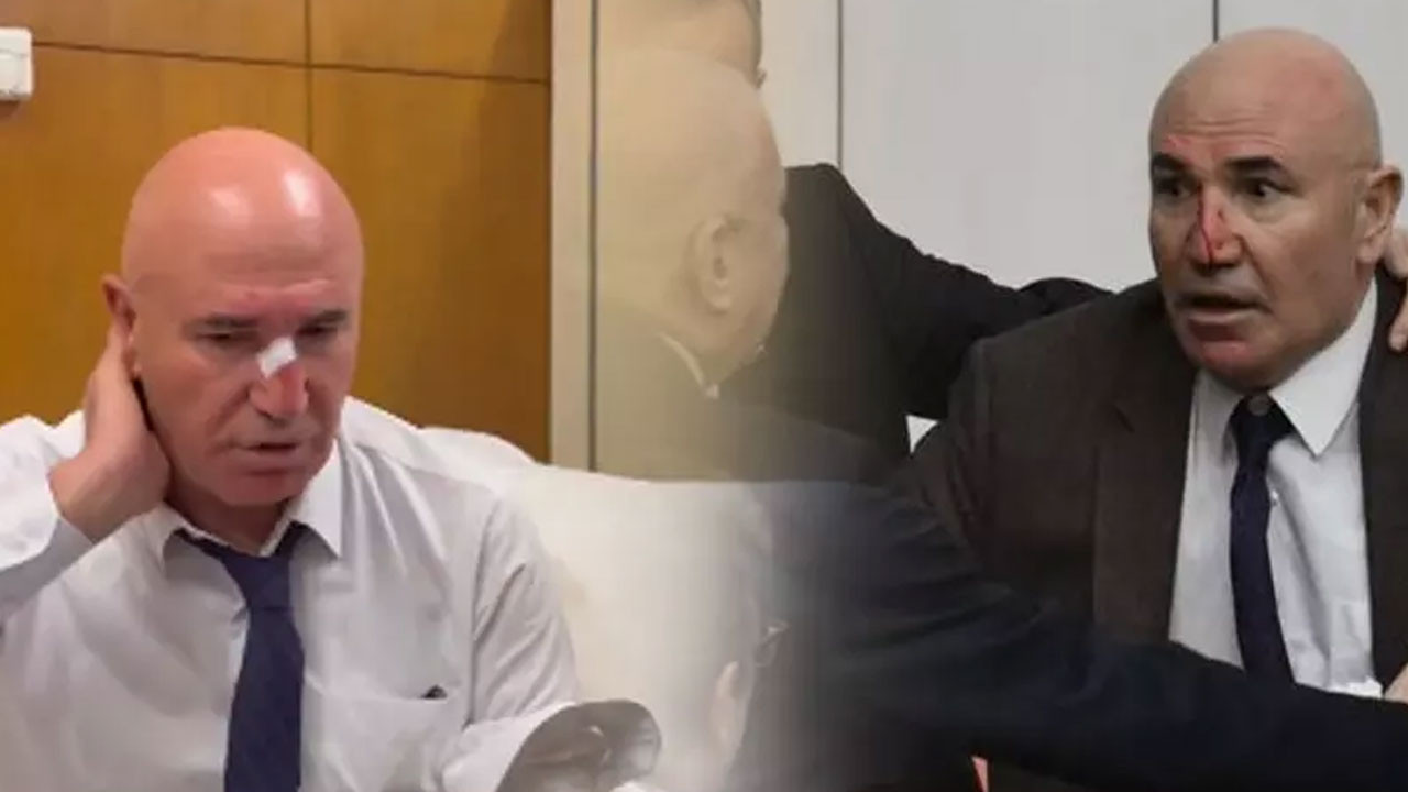 Meclis'teki yumruklu kavgada CHP'li Tanal'ın burnu kanadı! İlk müdahale revirde yapıldı