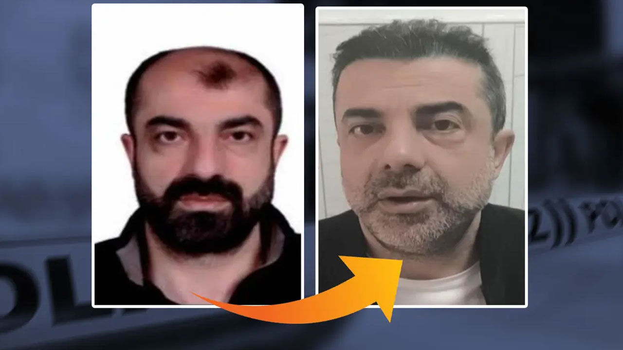 Ankara'da film gibi olay: Ameliyatla yüzünü değiştirip saç ektiren cinayet zanlısı yedi yıl sonra yakalandı