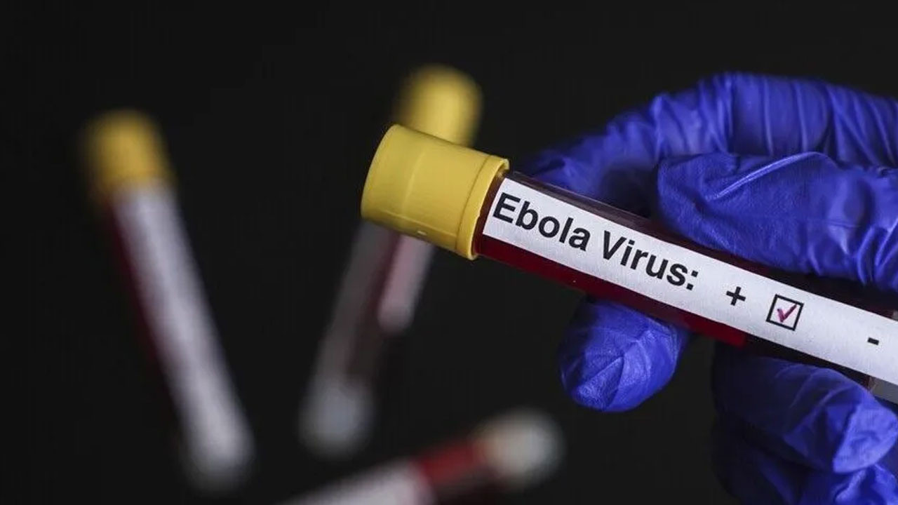 Kongo'da Ebola salgını: Can kaybı artıyor