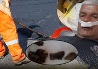 Yılların tozu ve çimentosu burnunda taşa dönüştü! 27 yıl sonra ortaya çıktı, doktorlar şoke oldu