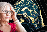 Erkeklerde demansı yüzde 60 oranında azaltabilir! 35 yıl önce başlatılan çalışma