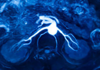 Gizemli kanser artışını araştıran gazeteci 29 yaşında hastalığa yakalandı... ‘Sağlık editörü olmama rağmen bu belirtileri ben bile kaçırdım'