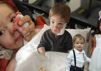 2 kardeşe saldırıp hastanelik etti! Pitbullun sahibinden pişkin savunma