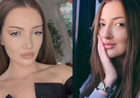 Danla Bilic itiraf etti: Alkol bağımlısı oldum