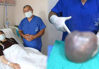 Fazla kilo zannediyordu: Karnından çıktı! 6,4 kilo...