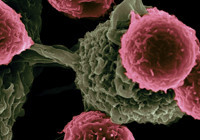 Kanseri önceden tespit edecek test geliyor