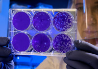 Avrupa'da 166 "gizemli hepatit" vakası tespit edildi