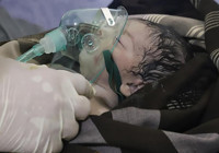 DSÖ'den korkutan 'gizemli hepatit' açıklaması