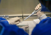 Maymun çiçeği hastalığı belirtilerine dikkat! 42 yaş altı tehlike altında