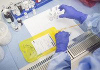 DSÖ’den "gizemli hepatit" açıklaması…