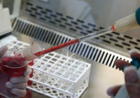 Felce en yatkın kan grubu açıklandı