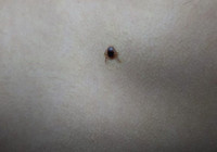 Yozgat'ta keneden ölenlerin sayısı 6'ya yükseldi