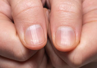 Tırnaklarınıza iyi bakın! O hastalığın habercisi olabilir