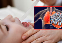 Strep A tam anlamıyla nedir, nasıl bulaşır? Strep A belirtileri, teşhis ve tedavisi...