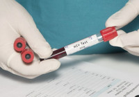 Prof. Dr. Şener: Sessiz bir HIV pandemisi var