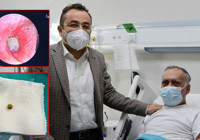 Akciğerine kaçan bezelye ameliyatla çıkarıldı