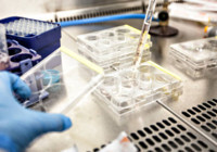 Dünyada kanser vakalarında 2020'ye kıyasla 2040'a kadar yüzde 55 artış bekleniyor