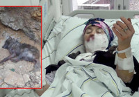 Kurt saldırısına uğrayan kadın: Önce yüzümü ısırdı