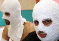 Erzurum'da çakmak doldururken hastanelik oldular