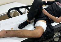 Erzurum’da bozayı saldırısına uğrayan çocuk yaralandı