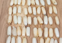 İlginç olayın adresi Gümüşhane! Yabancı uyruklunun bağırsağından çıkarıldı