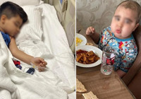 Yanlış teşhisle 2 buçuk yıl kemoterapi aldı: Saçları dökülen 6 yaşındaki çocuk romatizma çıktı