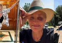 Sharon Stone tuvalette kaza geçirdi