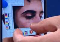 Narin'in ağabeyi Enes Güran'ın kolundaki ısırık izlerinin fotoğrafları ortaya çıktı