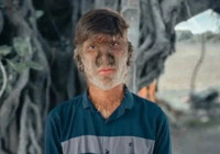 Asırlar sonra hastalık yine ortaya çıktı, insanları 'kurt adama' dönüştürüyor: Kıllanmanın sebebi saç spreyi mi?