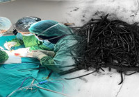 Mersin'de akıllara durgunluk veren olay! Midesinden 1 kilo metal cisim çıktı