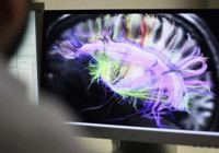 Beyin kanserine yakalandı: 14 ay ömrü kaldı