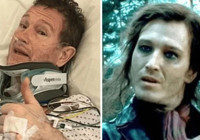 Harry Potter serisinin ünlü yıldızından acı haber! Apar topar hastaneye kaldırıldı