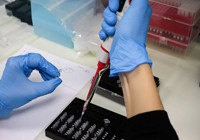 Dünyanın en tembel kan grubu bakın hangisi! Bu haberi okuduktan sonra fikriniz değişecek