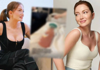 Danla Bilic'in kalçasından çıkana bakın! Dolgu maddesi ağızları açık bıraktı