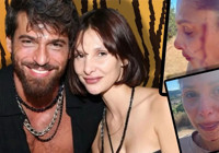 Can Yaman'ın sevgilisi, kanlar içinde paylaşım yaptı: Çocuğumun babasından şiddet görüyorum