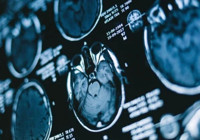 5,5 ay daha hızlı yaşlanıyormuşuz! Covid'in gizli etkisi yıllar sonra ortaya çıktı