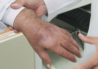 Hırsız öyle bir ısırdı ki; literatüre girmeye aday!