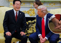 Trump'ın elindeki 'koyu leke' dikkat çekti!