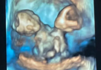 Ultrasonda gördüğü anda dünyası başına yıkıldı!