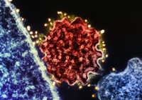 Sepsis her yıl 11 milyon can alıyor! Dikkat herkes risk grubunda!