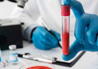 Kansızlığı anlamanın 7 sinyali: Bu belirtiler varsa dikkat