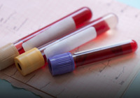 Erken tanıda devrim: 50’den fazla kanser türünü tespit eden kan testi