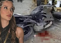 İrem Helvacıoğlu ve kızı kazada ölümden döndü! Hastanelik oldu, dikiş atıldı