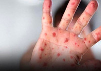 Virüs hızla yayılıyor! Tüm dünya teyakkuzda