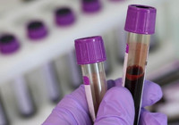 Kan kanserinde "immünoterapilerle" tedavide yeni dönem