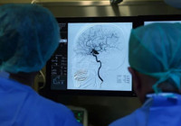 Dikkat çeken araştırma! İnsan beyni 32 yaşına kadar ergenlik döneminde