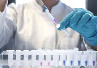 DSÖ: 2024'te 1,3 milyon kişinin AIDS hastalığına yakalandı