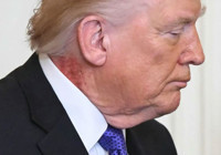Trump'ın boynundaki kırmızı leke gündem oldu! Beyaz Saray'dan açıklama var