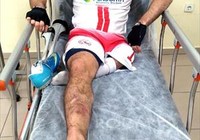 Ampute futbolcu, az kalsın tek bacağından da oluyordu