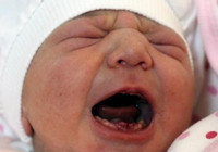 Amasya'da şaşkına çeviren doğum! Bebek 9 dişli dünyaya geldi!